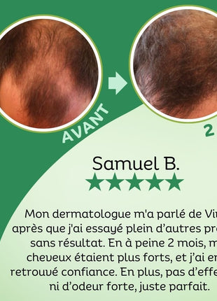 Masque Capillaire Hydratant au Romarin Vivaci-4