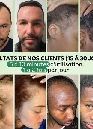 Pack Régulation & Exfoliation Vivaci-1